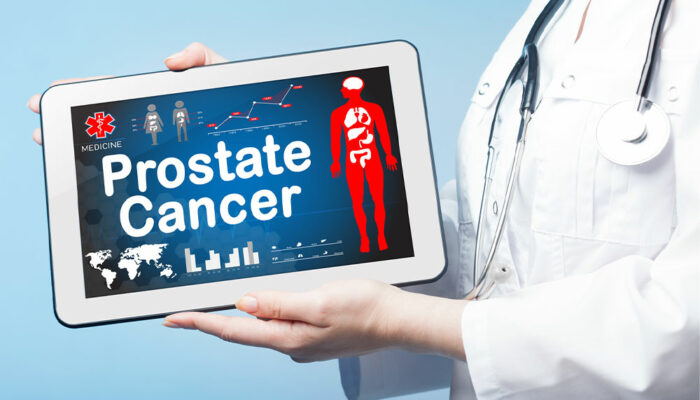 3 tips to help prevent and manage prostate cancer