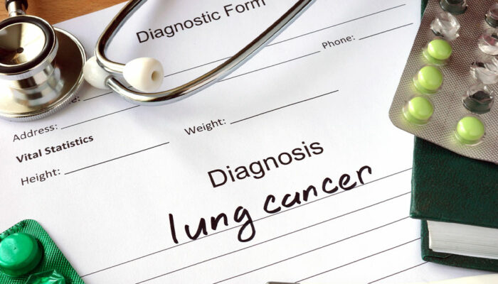 3 crucial tips for managing lung cancer