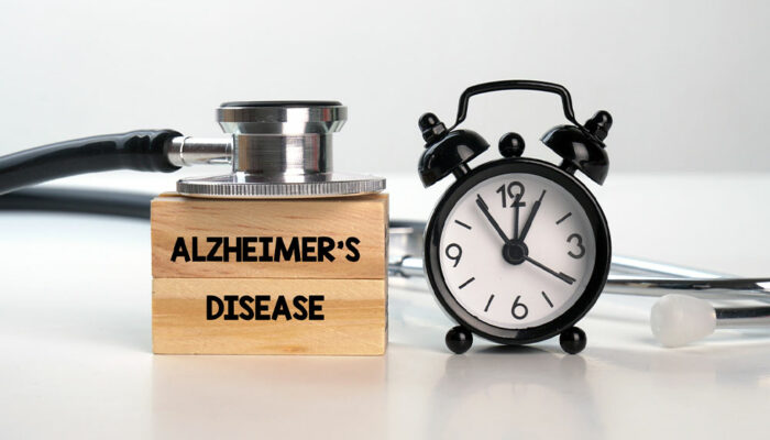 Alzheimer&#8217;s disease &#8211; 7 tips to manage the condition