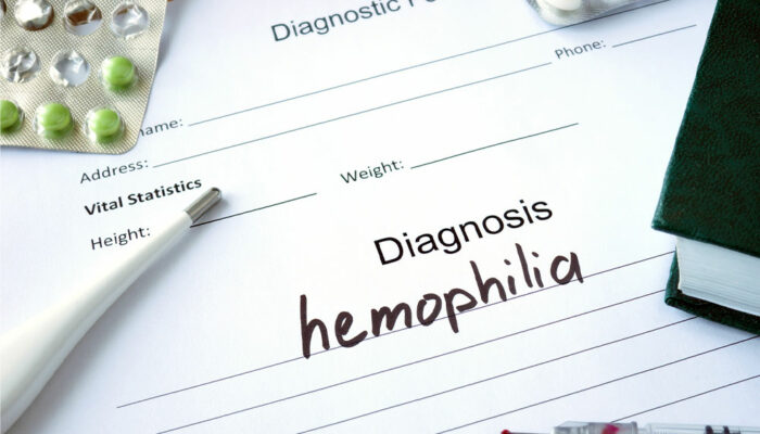 Hemophilia &#8211; Its types, symptoms, and management