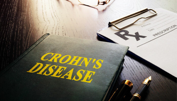 Top 10 early warning signs of Crohn&#8217;s