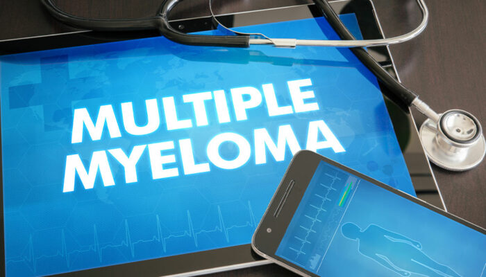 14 Signs of Multiple Myeloma to Look Out for