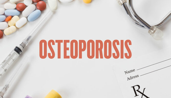 7 Conditions That Increase the Risk of Osteoporosis