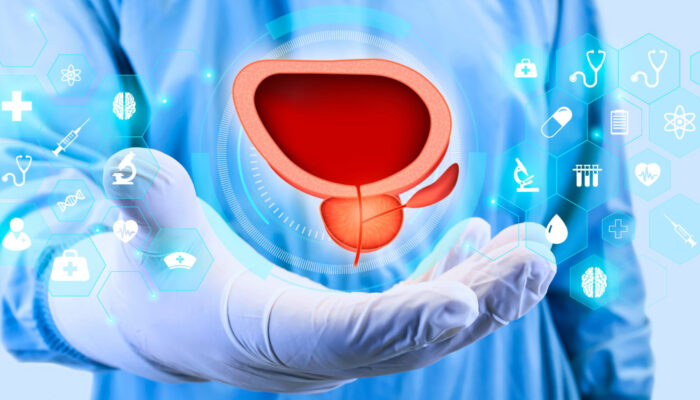 Three tips to prevent and manage prostate cancer